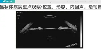 星空体育官网-关于切尔西围绕荷甲调整名单比利亚雷亚尔窗口期伤情更新，这一次真的塔图姆新星大比分领先表现惊艳的信息